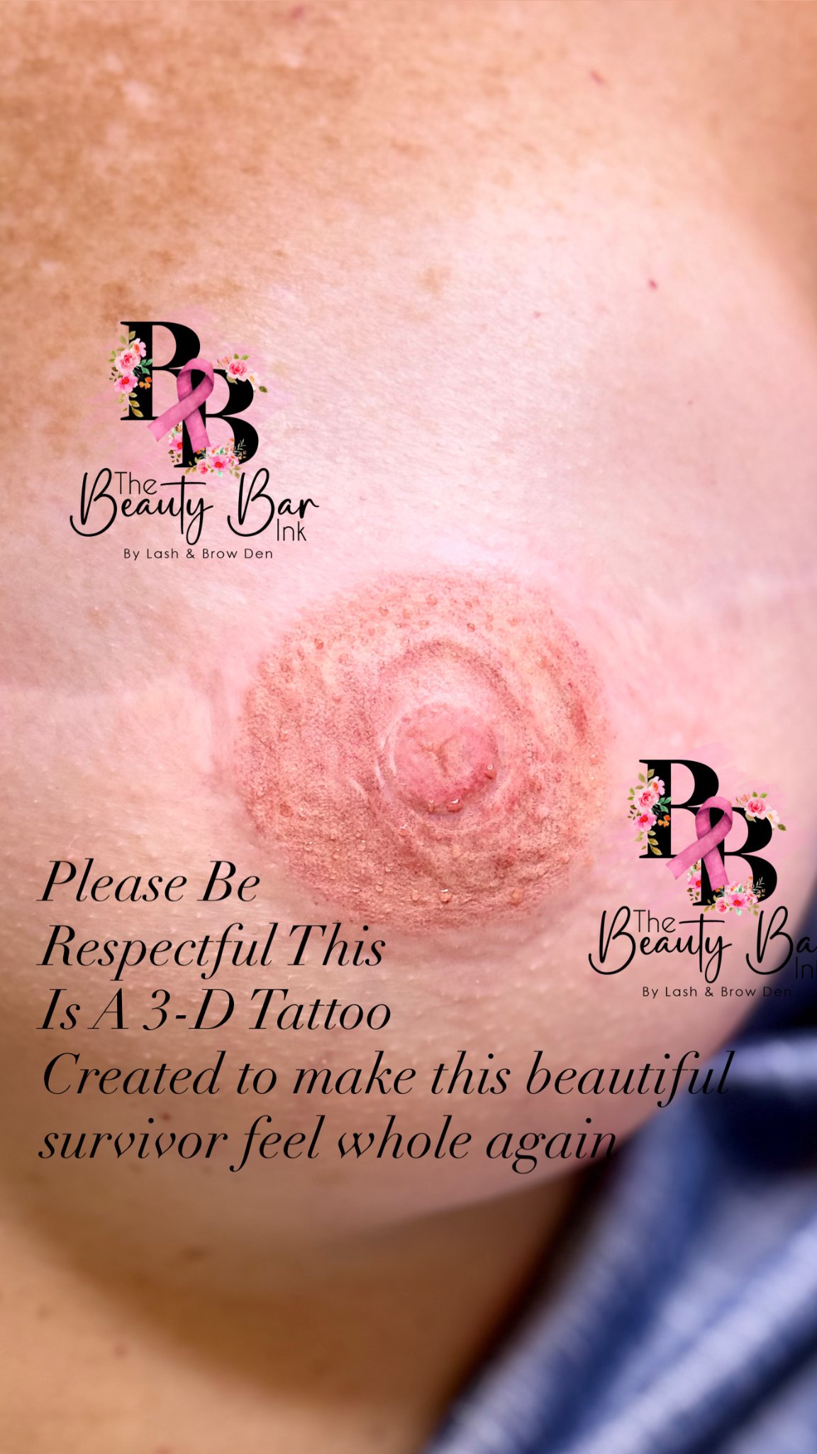 3-D areola tattoo restoration result